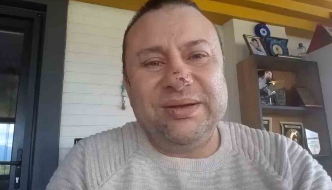 Pitbull saldırısına uğrayan Onur Akay o anları anlattı: “Ben ölümden döndüm”